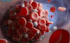 پلاکت خون چیست و علائم تعداد پلاکت پایین (ترومبوسیتوپنی)