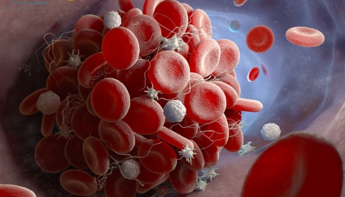پلاکت خون چیست و علائم تعداد پلاکت پایین (ترومبوسیتوپنی)